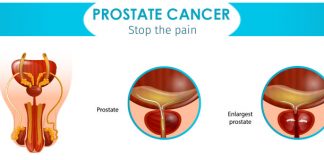 What is the secret to avoiding prostate cancer?