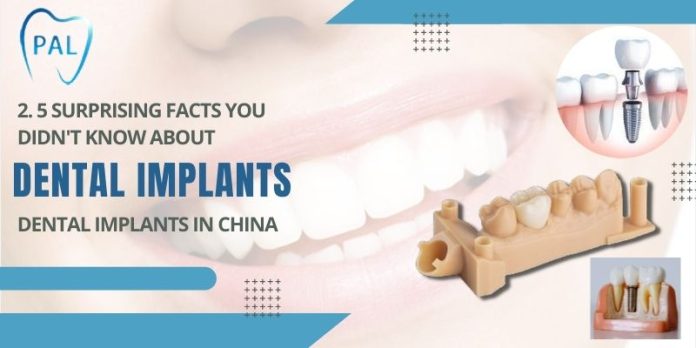 Dental Implants in China